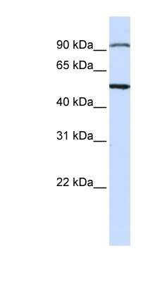 Western Blot: AMSH/STAMBP Antibody [NBP1-58334]