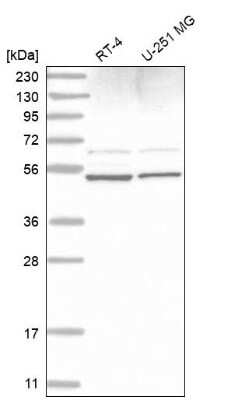 Western Blot: AMSH/STAMBP Antibody [NBP2-68627]