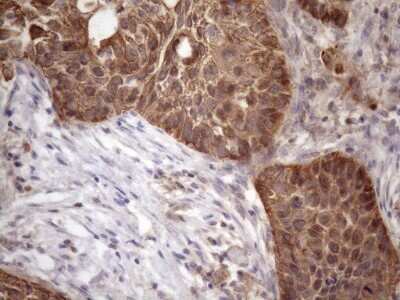 Immunohistochemistry: AMTN Antibody (OTI2D9) [NBP2-46517]