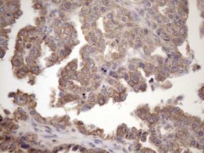 Immunohistochemistry: AMTN Antibody (OTI2D9) [NBP2-46517]