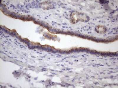 Immunohistochemistry: AMTN Antibody (OTI2D9) [NBP2-46517]