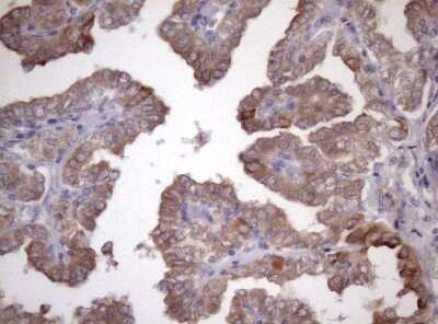 Immunohistochemistry: AMTN Antibody (OTI2D9) [NBP2-46517]