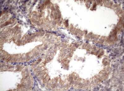 Immunohistochemistry: AMTN Antibody (OTI2D9) [NBP2-46517]