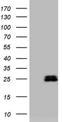 Western Blot: AMTN Antibody (OTI2D9) [NBP2-46517]