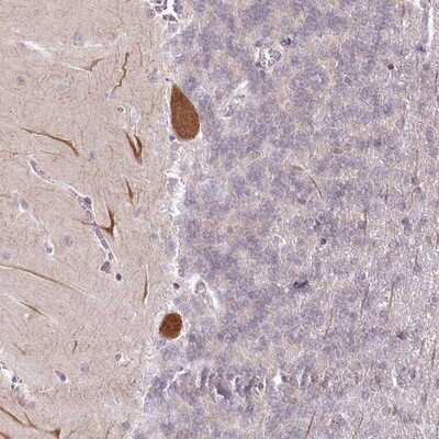 Immunohistochemistry-Paraffin: AMTN Antibody [NBP1-80809]