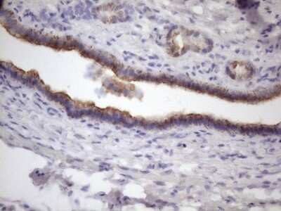 Immunohistochemistry: AMTN Antibody (OTI2D9) - Azide and BSA Free [NBP2-72507]
