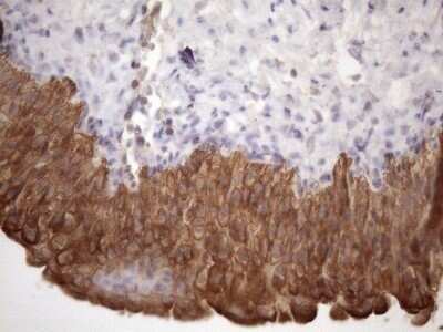 Immunohistochemistry: AMTN Antibody (OTI2D9) - Azide and BSA Free [NBP2-72507]