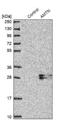 Western Blot: AMTN Antibody [NBP2-32718]