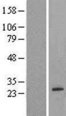 Western Blot: AMTN Overexpression Lysate [NBP2-04474]