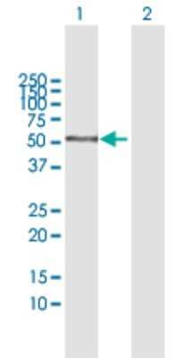 Western Blot: AMY1C Antibody [H00000278-B01P]