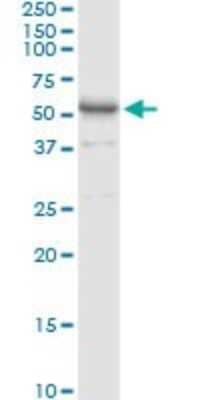 Western Blot: AMY1C Antibody [H00000278-D01P]