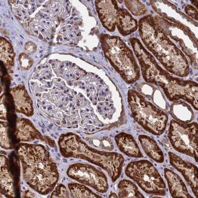 Immunohistochemistry-Paraffin: ANAPC13 Antibody [NBP1-91664]