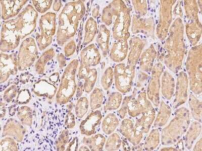 Immunohistochemistry-Paraffin: ANAPC13 Antibody [NBP2-97529]