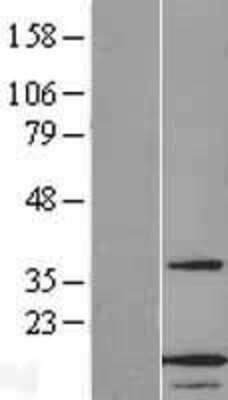 Western Blot: ANAPC13 Overexpression Lysate [NBL1-07515]