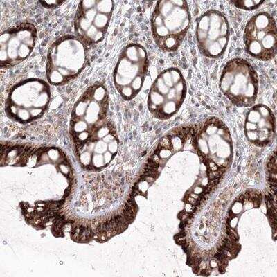 Immunohistochemistry-Paraffin: ANAPC16 Antibody [NBP1-89048]