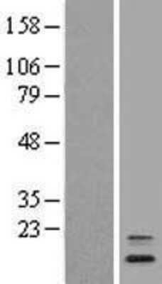 Western Blot: ANAPC16 Overexpression Lysate [NBL1-08068]