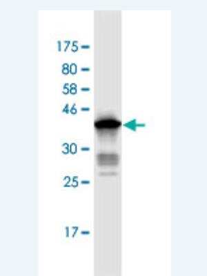 Western Blot: ANAPC2 Antibody (7F2) [H00029882-M02]