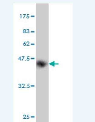 Western Blot: ANAPC2 Antibody (8G2) [H00029882-M01]