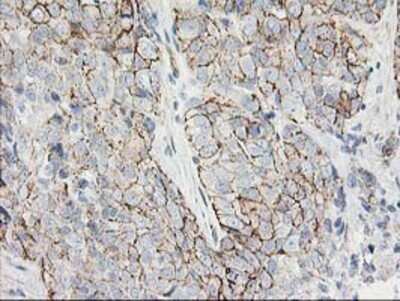 Immunohistochemistry: ANAPC2 Antibody (OTI1A6) - Azide and BSA Free [NBP2-71860]