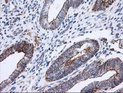 Immunohistochemistry: ANAPC2 Antibody (OTI1A6) - Azide and BSA Free [NBP2-71860]