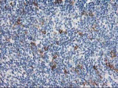 Immunohistochemistry: ANAPC2 Antibody (OTI1A6) - Azide and BSA Free [NBP2-71860]