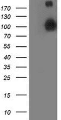 Western Blot: ANAPC2 Antibody (OTI1A6)Azide and BSA Free [NBP2-71860]