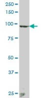 Western Blot: ANAPC2 Antibody [H00029882-B01P]