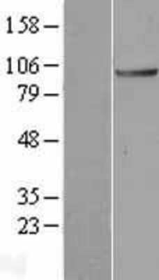 Western Blot: ANAPC2 Overexpression Lysate [NBL1-07516]