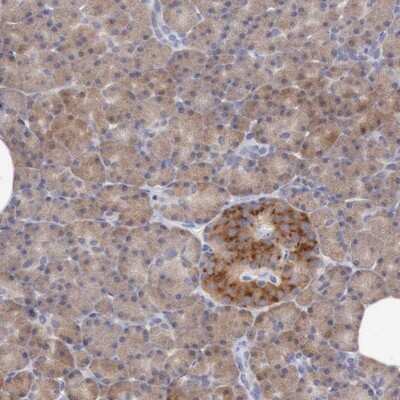 Immunohistochemistry-Paraffin: ANGEL1 Antibody [NBP1-81481]