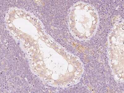 Immunohistochemistry-Paraffin: ANGEL1 Antibody [NBP2-99240]