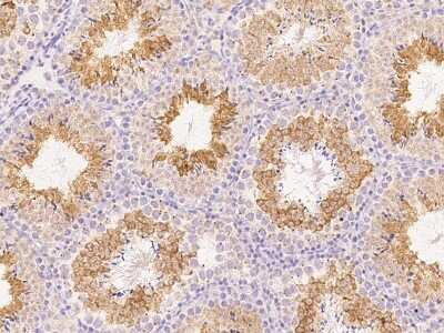 Immunohistochemistry-Paraffin: ANGEL1 Antibody [NBP2-99240]
