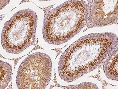 Immunohistochemistry-Paraffin: ANGEL1 Antibody [NBP2-99240]