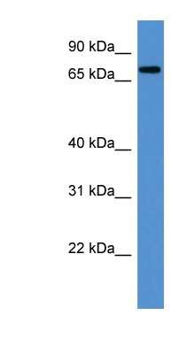 Western Blot: ANGEL1 Antibody [NBP1-79580]