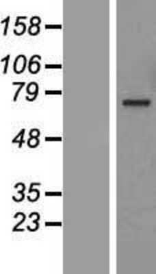 Western Blot: ANGEL1 Overexpression Lysate [NBL1-07520]