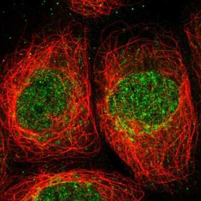 Immunocytochemistry/ Immunofluorescence: ANGEL2 Antibody [NBP1-83712]