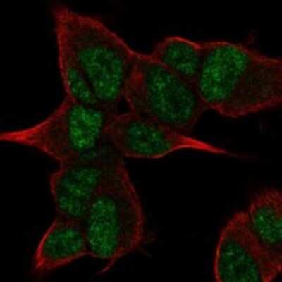 Immunocytochemistry/ Immunofluorescence: ANGEL2 Antibody [NBP3-17339]