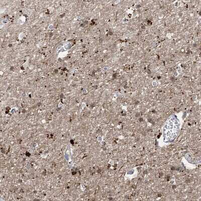 Immunohistochemistry-Paraffin: ANGEL2 Antibody [NBP1-83712]