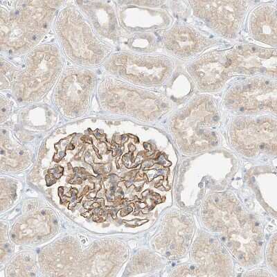 Immunohistochemistry-Paraffin: ANGEL2 Antibody [NBP1-83712]