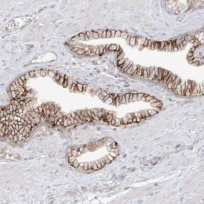 Immunohistochemistry-Paraffin: ANGEL2 Antibody [NBP1-83712]