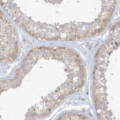 Immunohistochemistry-Paraffin: ANGEL2 Antibody [NBP1-83712]