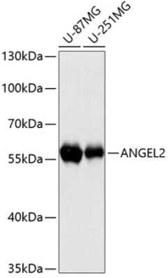 Western Blot: ANGEL2 AntibodyAzide and BSA Free [NBP2-92088]