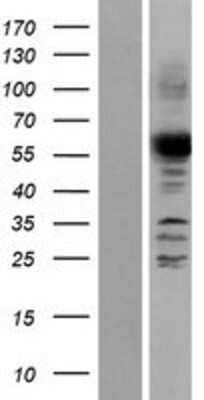 Western Blot: ANGEL2 Overexpression Lysate [NBP2-05558]