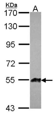 Western Blot: Angiopoietin-like Protein 1/ANGPTL1 Antibody [NBP2-15389]