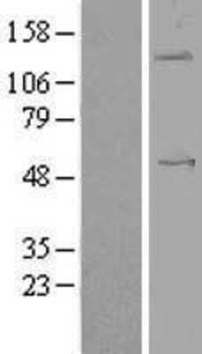 Western Blot: Angiopoietin-like Protein 1/ANGPTL1 Overexpression Lysate [NBL1-07524]