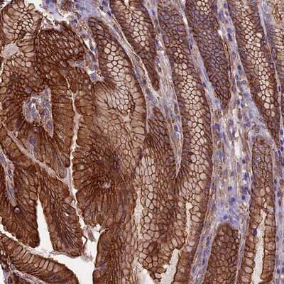 Immunohistochemistry-Paraffin: Angiopoietin-like Protein 2/ANGPTL2 Antibody [NBP1-88997]