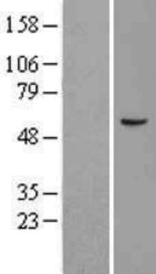 Western Blot: Angiopoietin-like Protein 2/ANGPTL2 Overexpression Lysate [NBL1-07525]