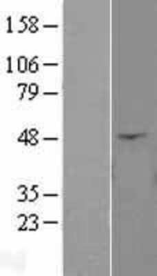 Western Blot: Angiopoietin-like Protein 4/ANGPTL4 Overexpression Lysate [NBL1-07527]