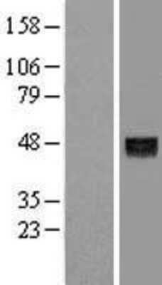 Western Blot: Angiopoietin-like Protein 5/ANGPTL5 Overexpression Lysate [NBL1-07528]