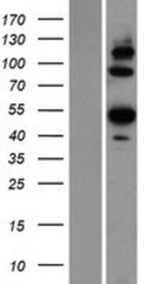 Western Blot: Angiopoietin-like Protein 6/ANGPTL6 Overexpression Lysate [NBP2-06100]