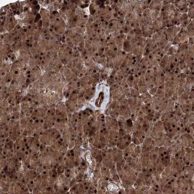 Immunohistochemistry-Paraffin: ANKAR Antibody [NBP1-93912]